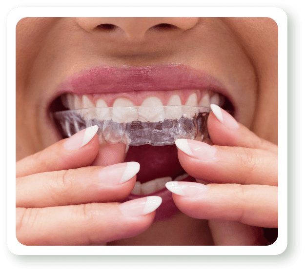 invisalign in sw calgary